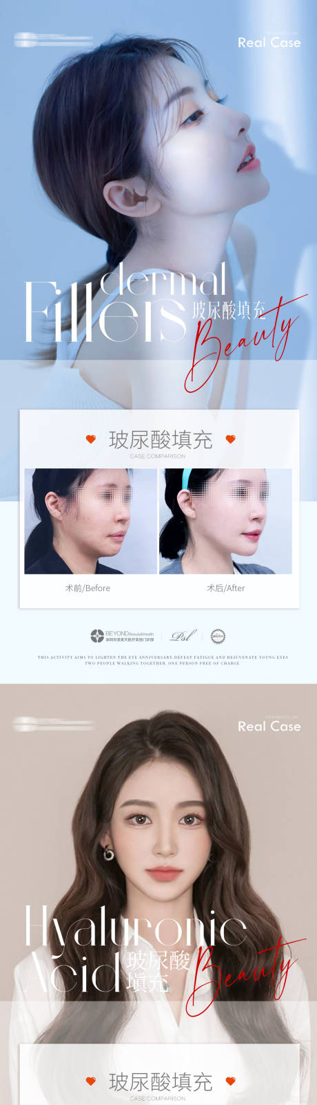 源文件下载【医美填充案例对比】编号：85360017053742003