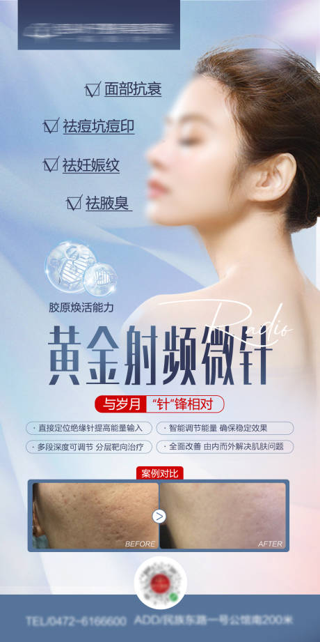 源文件下載【醫(yī)美海報黃金射頻微針】編號：92790016832708835
