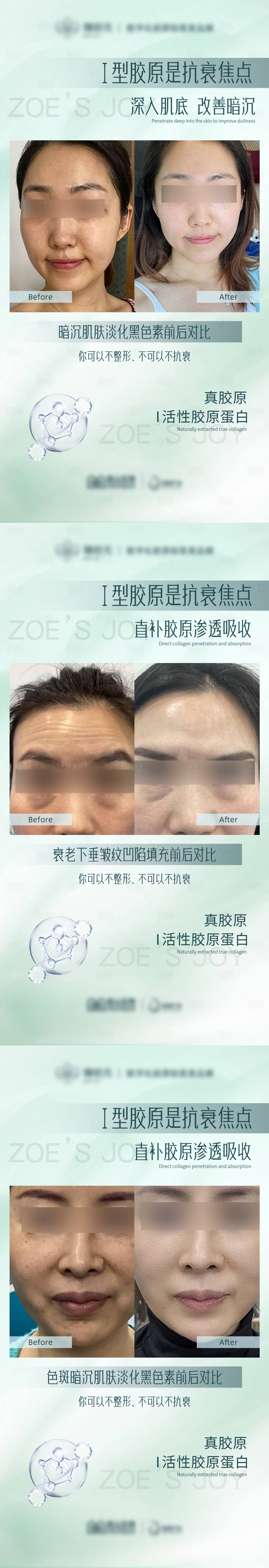 源文件下载【医美效果对比图系列海报】编号：62270016599277373