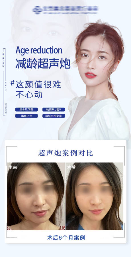 源文件下载【医美超声炮案例对比图】编号：71540016969233015