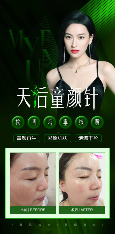 源文件下載【享設(shè)計】搜索編號：19790016513944276【天后童顏針案例對比圖】