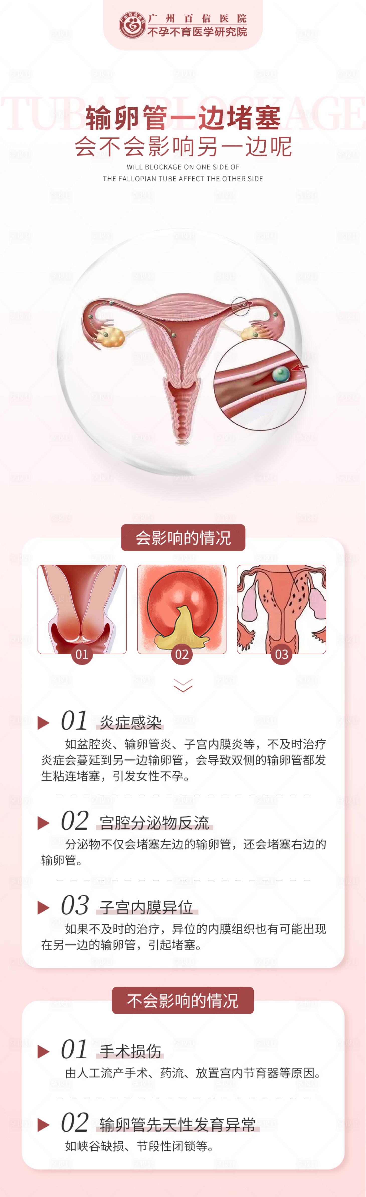 源文件下載【享設(shè)計(jì)】搜索編號(hào)：70610017058481496【輸卵管科普海報(bào)】