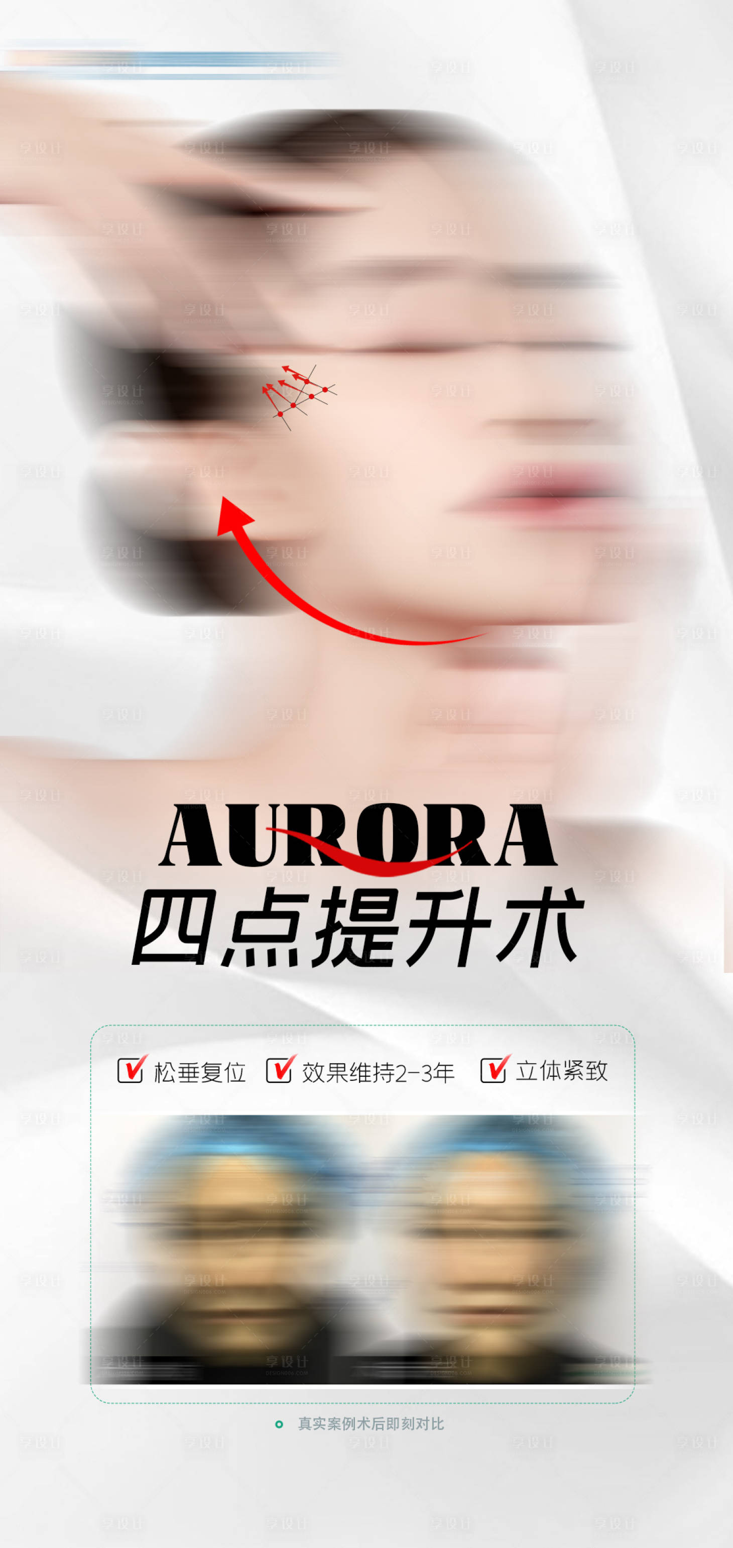 源文件下載【享設計】搜索編號：53470016443916568【醫美提升品宣活動海報】