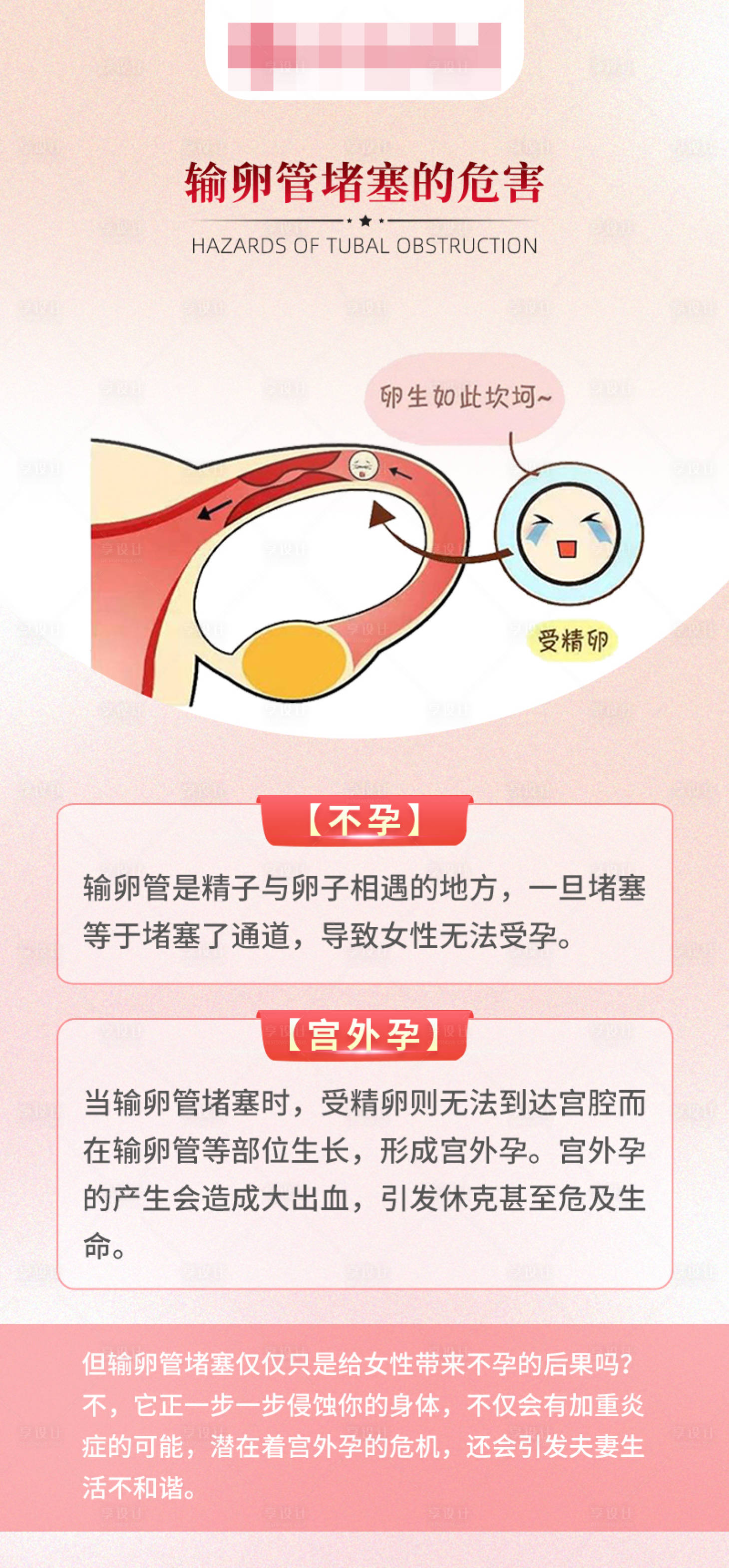 源文件下载【享设计】搜索编号：77250016673986079【输卵管堵塞科普海报】