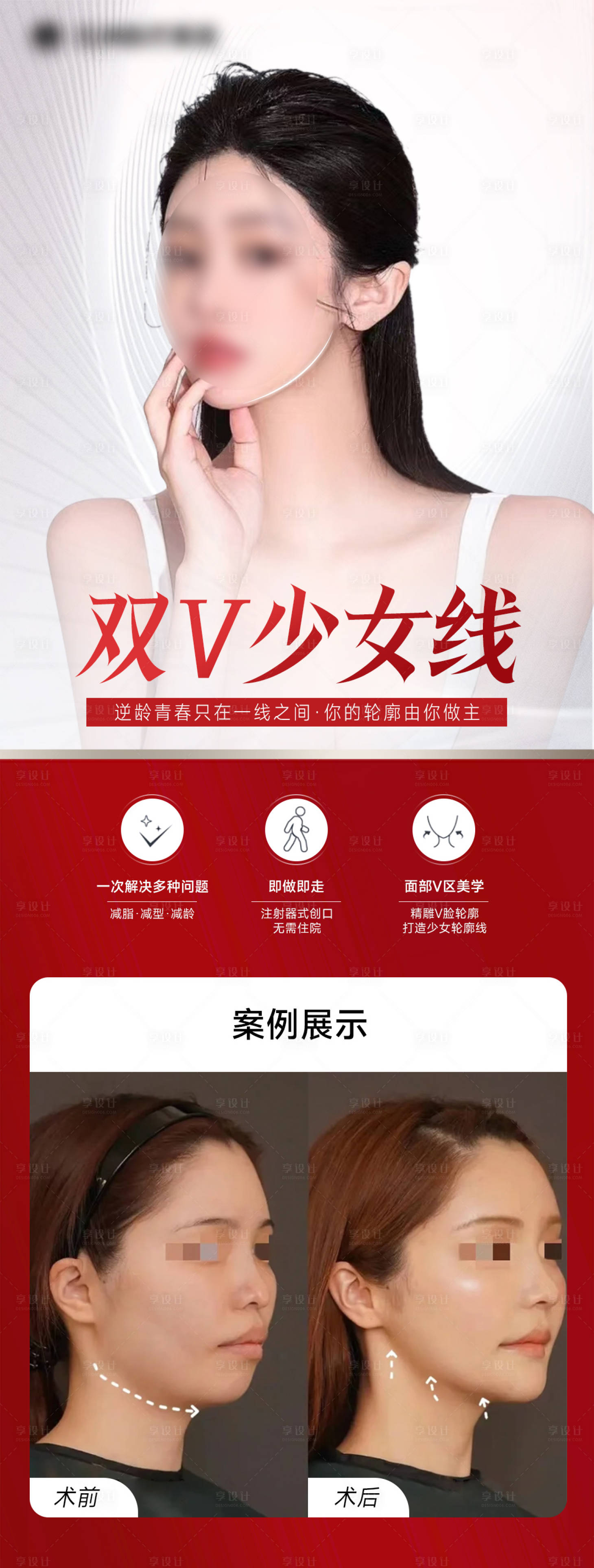 源文件下载【医美案例海报】编号：83390016477429926