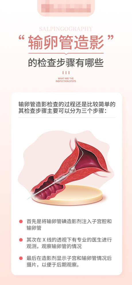 源文件下載【享設計】搜索編號：95220016490854729【輸卵管造影的檢查步驟有哪些科普海報】