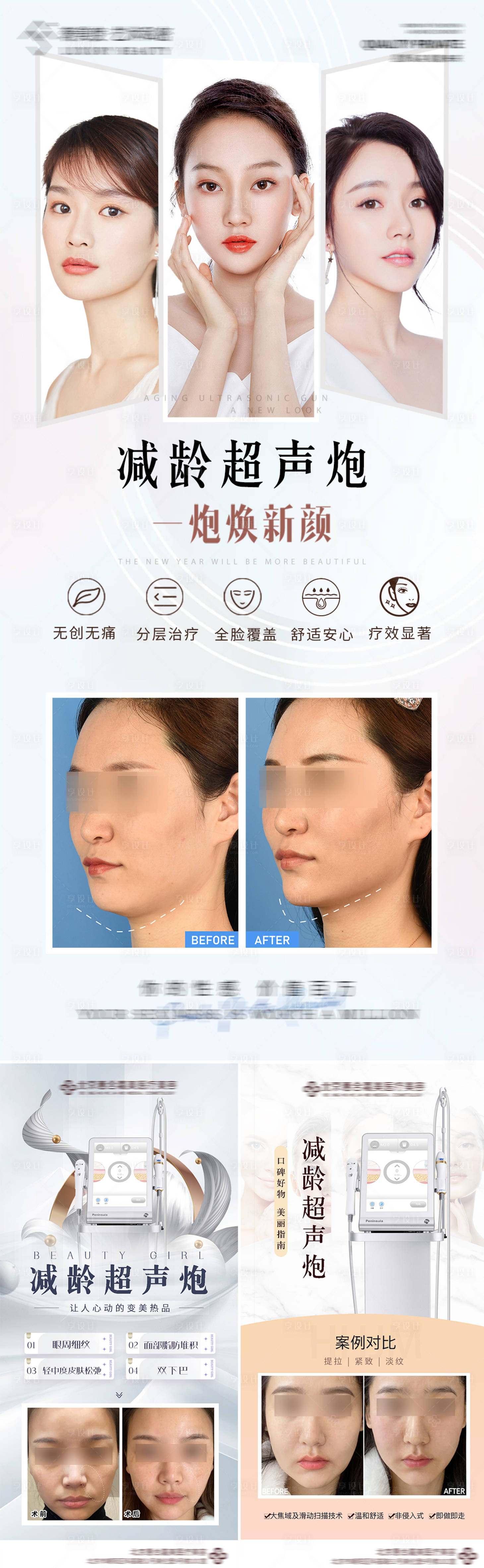 源文件下载【医美超声炮案例对比海报】编号：94710016968328438