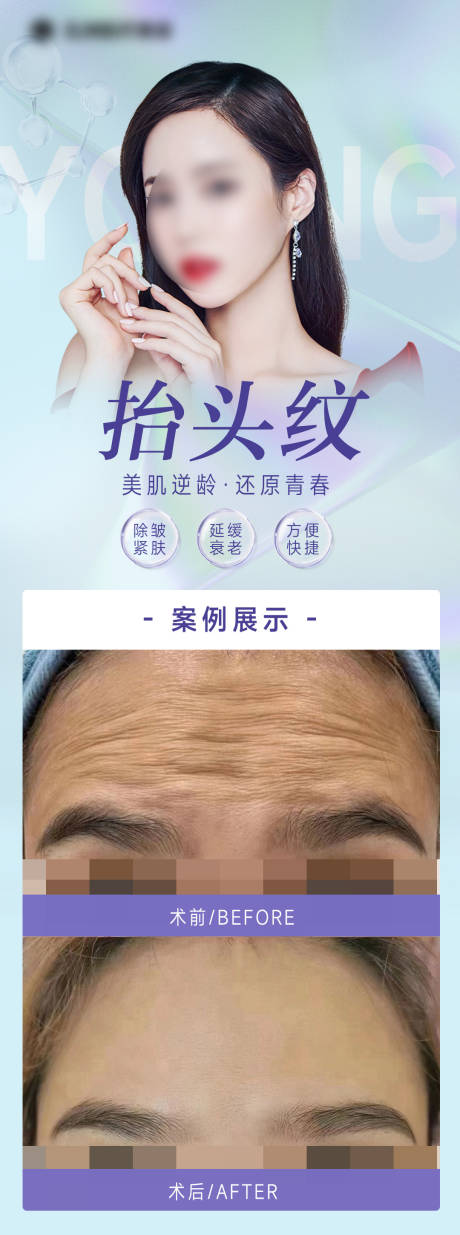 源文件下载【医美案例海报】编号：25640016477438194