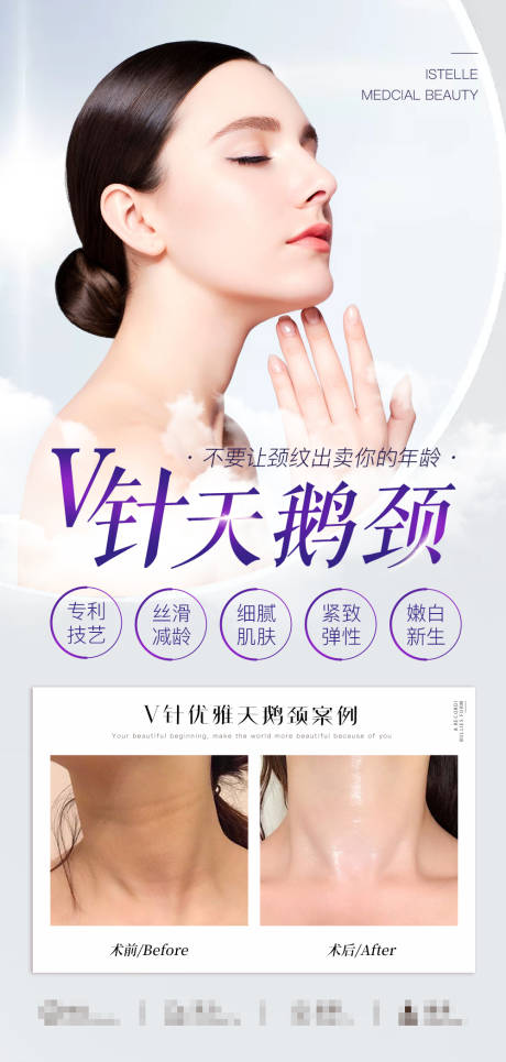 源文件下载【天鹅颈海报】编号：27790016472002338