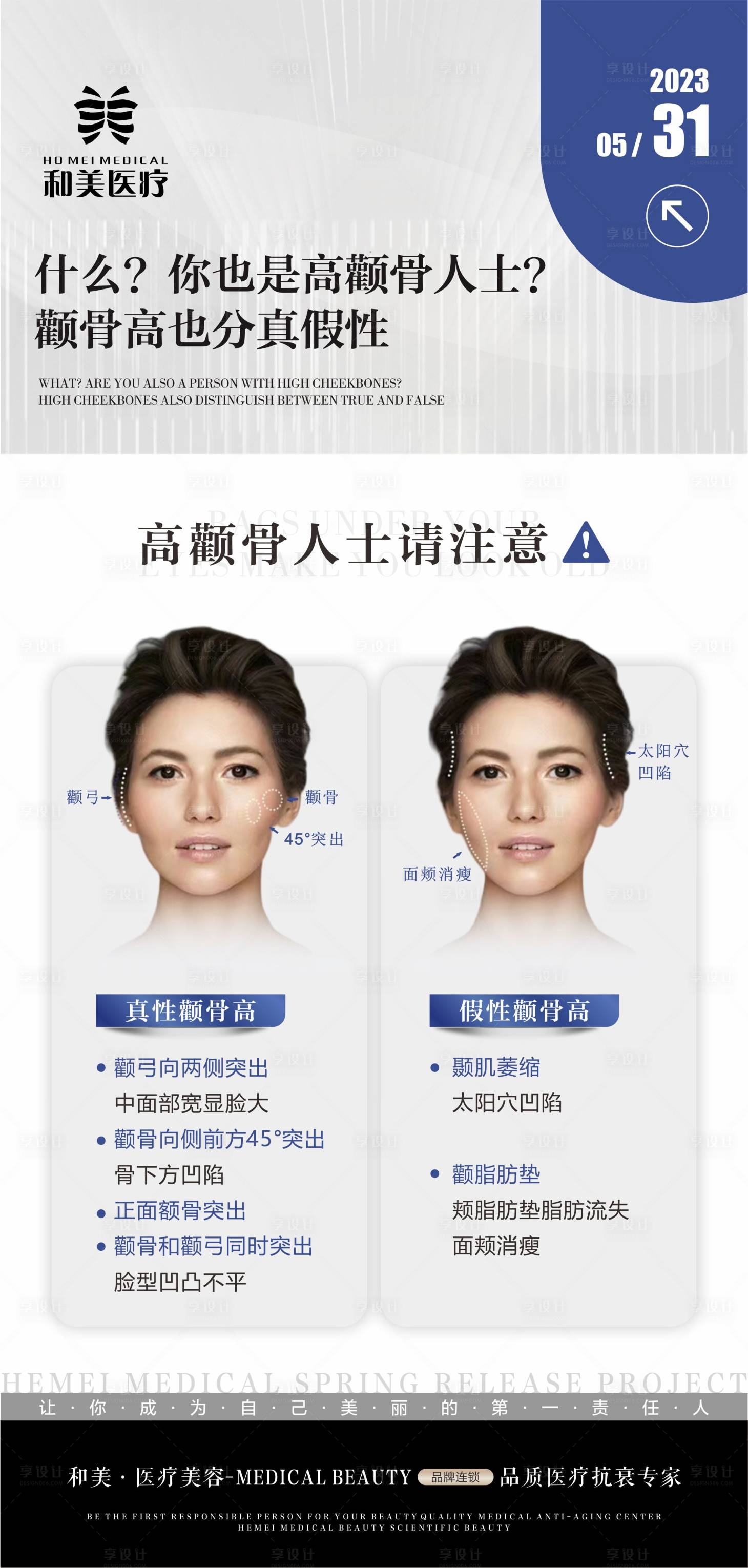 源文件下载【真假性颧骨科普海报】编号：15220017021294916