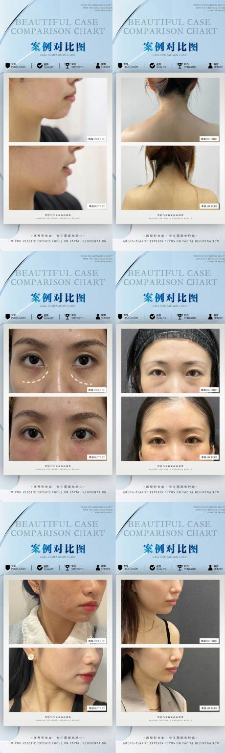 源文件下載【醫(yī)美整形案例】編號：82370016990275266