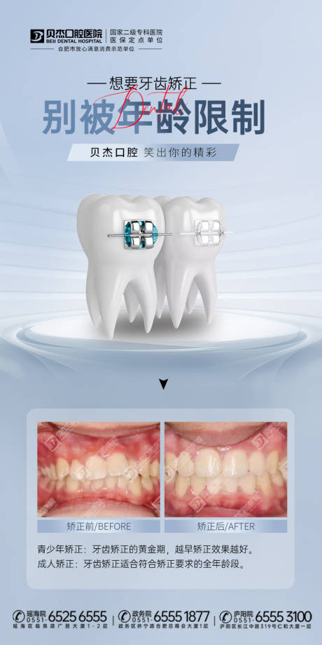 源文件下载【牙齿矫正海报】编号：20230507153821144