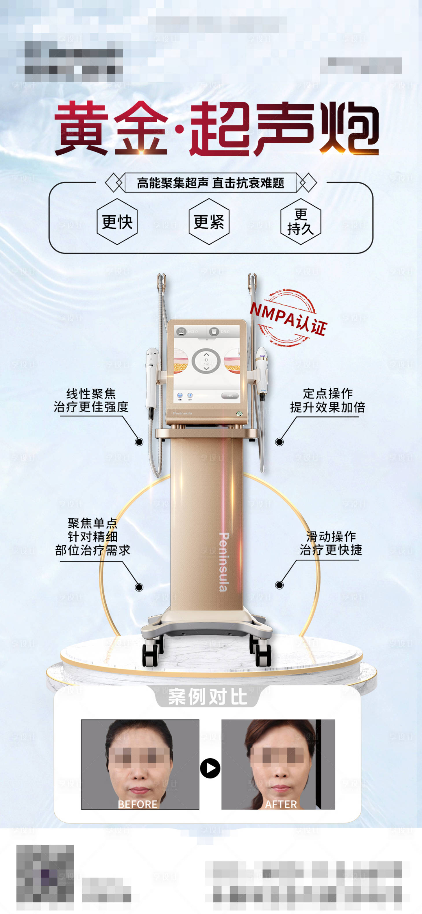 源文件下载【享设计】搜索编号：88060017019712393【黄金超声炮海报】