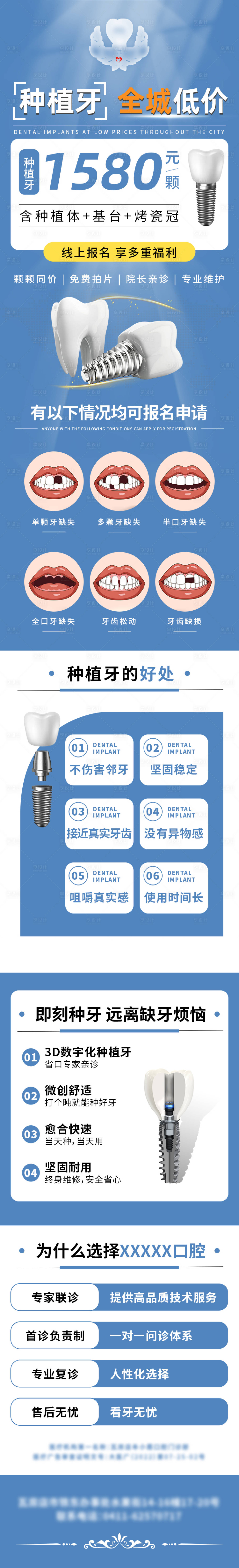 源文件下载【享设计】搜索编号：94840016592601725【口腔医疗种植牙】