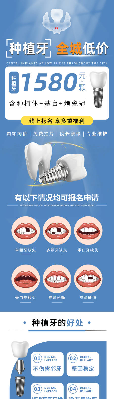 口腔医疗种植牙