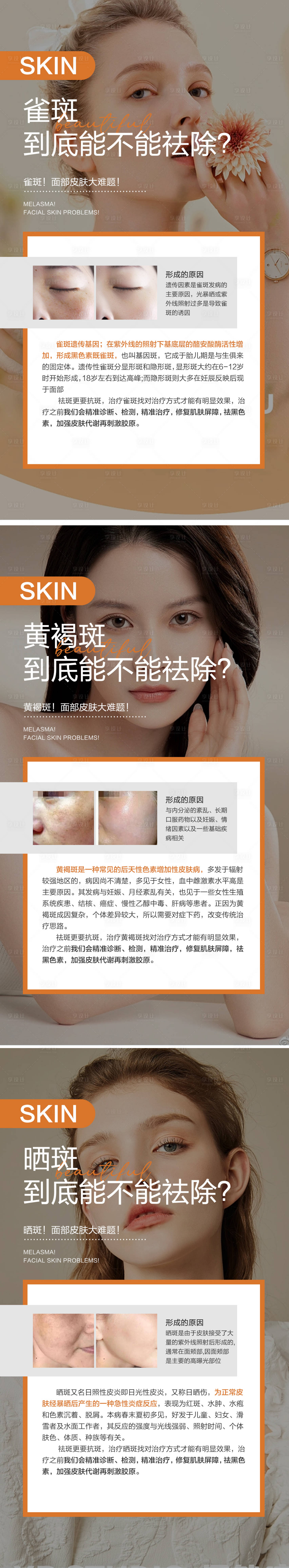 源文件下载【享设计】搜索编号：64830016797803265【皮肤科普系列海报】