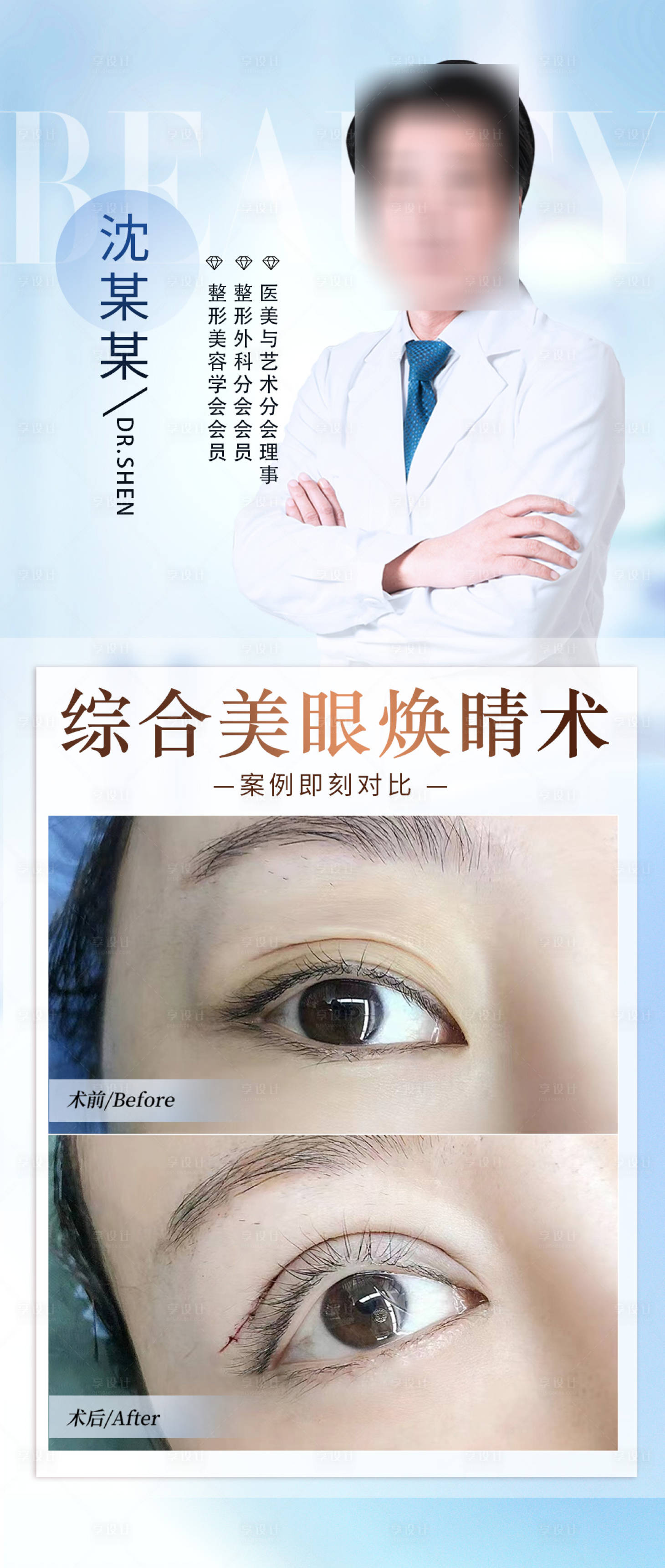 源文件下載【享設計】搜索編號：37020016956316833【雙眼皮眼部案例整形海報】