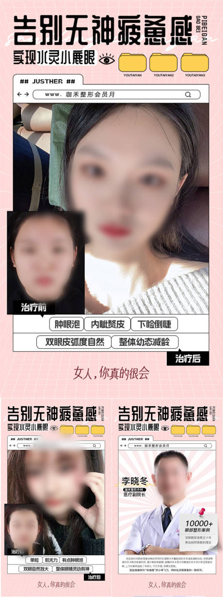 源文件下载【双眼皮案例对比海报】编号：89440016394446051