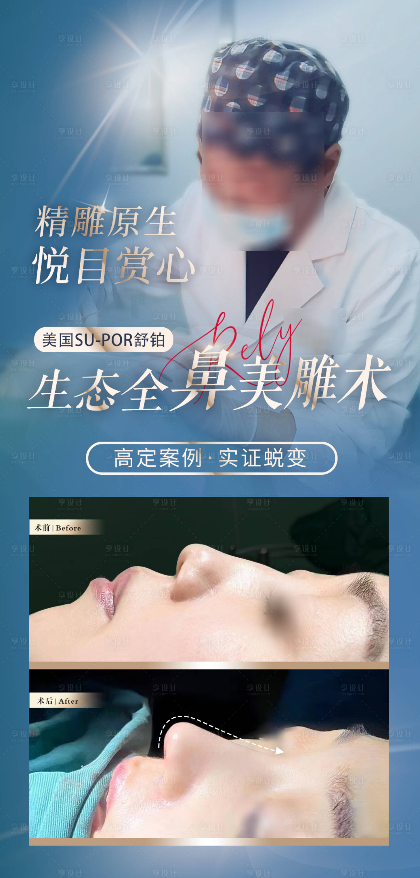 源文件下载【享设计】搜索编号：97580016626561411【医美线雕整形项目】