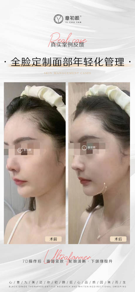 源文件下载【医美美容祛斑美白痘痘模特对比抗衰海报】编号：53490016479412962