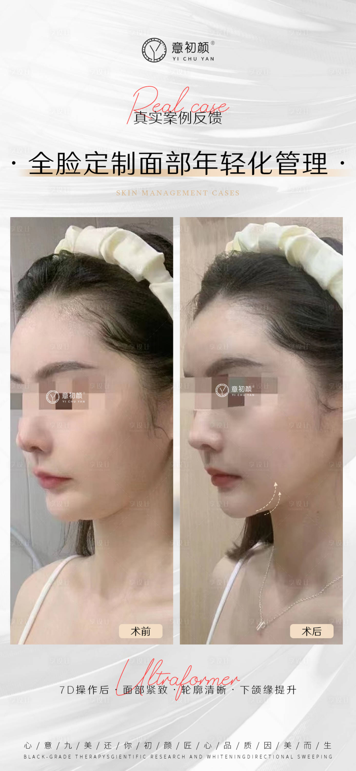 源文件下载【享设计】搜索编号：53490016479412962【医美美容祛斑美白痘痘模特对比抗衰海报】