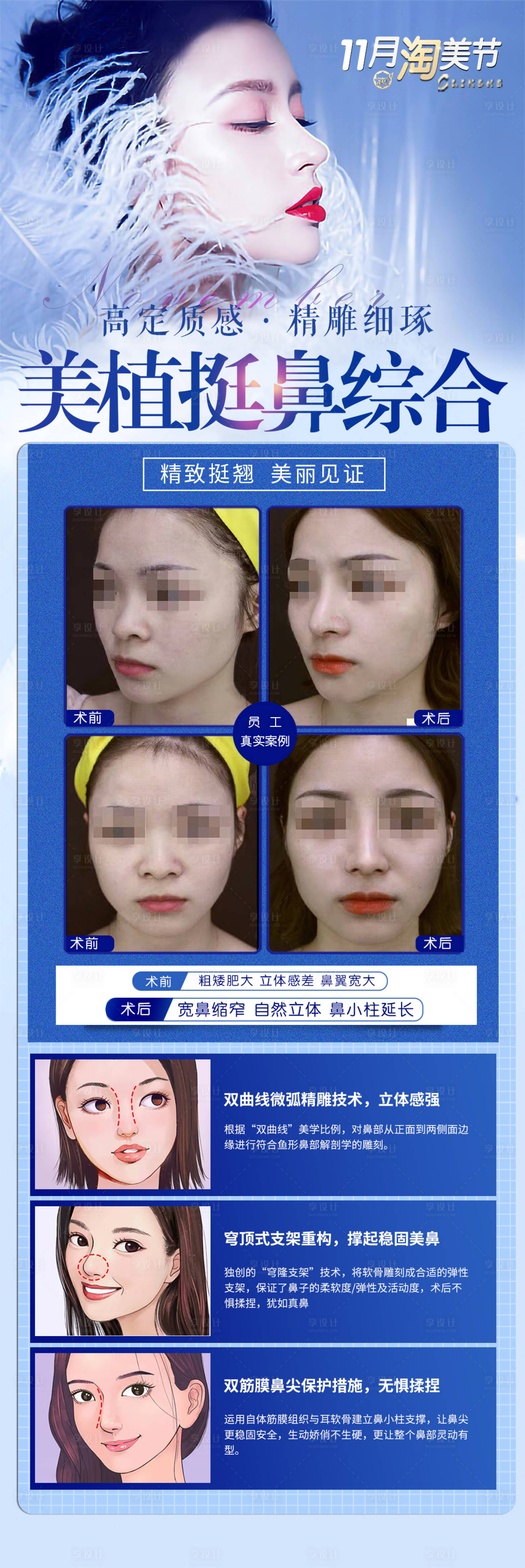 源文件下載【享設計】搜索編號：93380016453539642【藍色隆鼻海報】