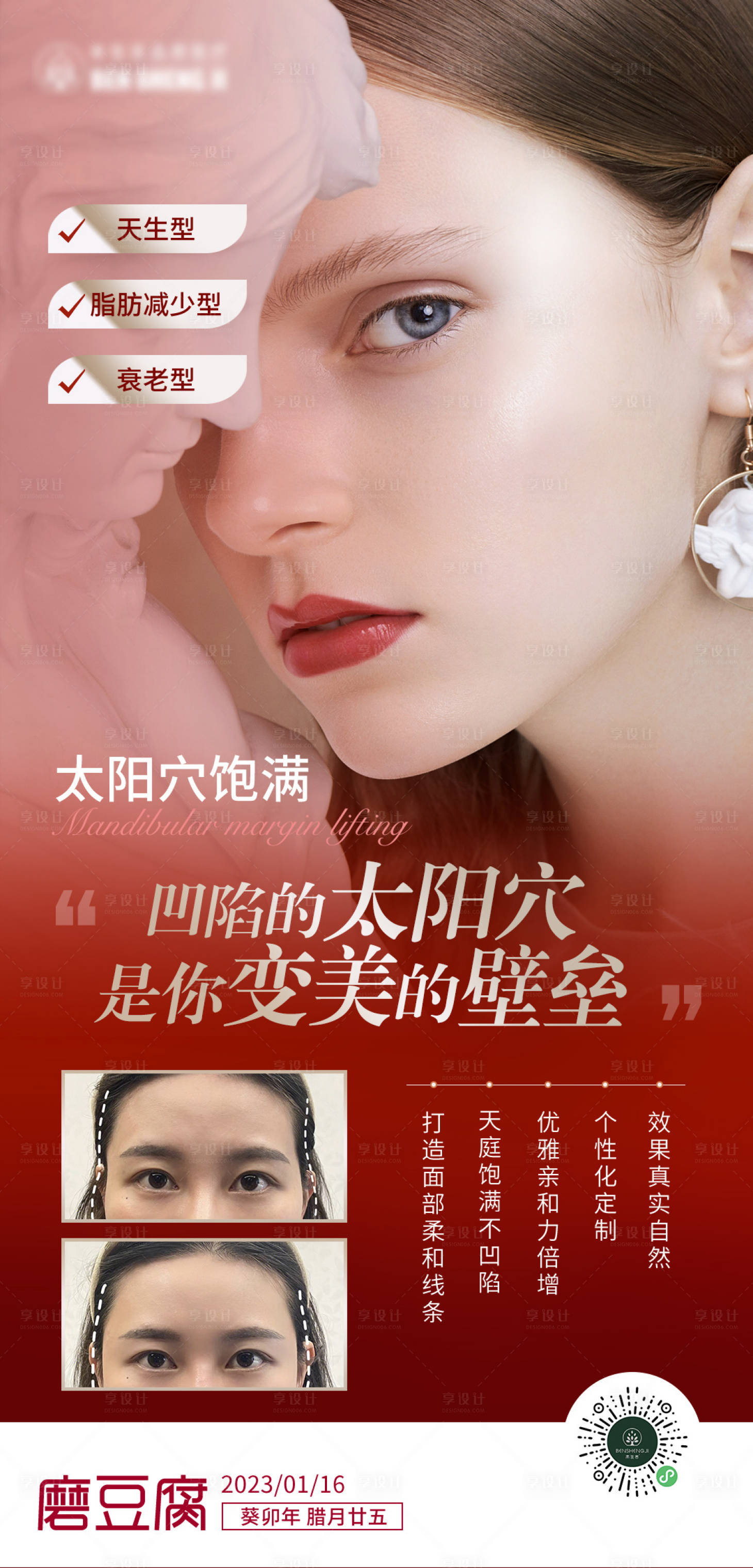 源文件下载【医美红色太阳穴饱满海报】编号：25660016991846374