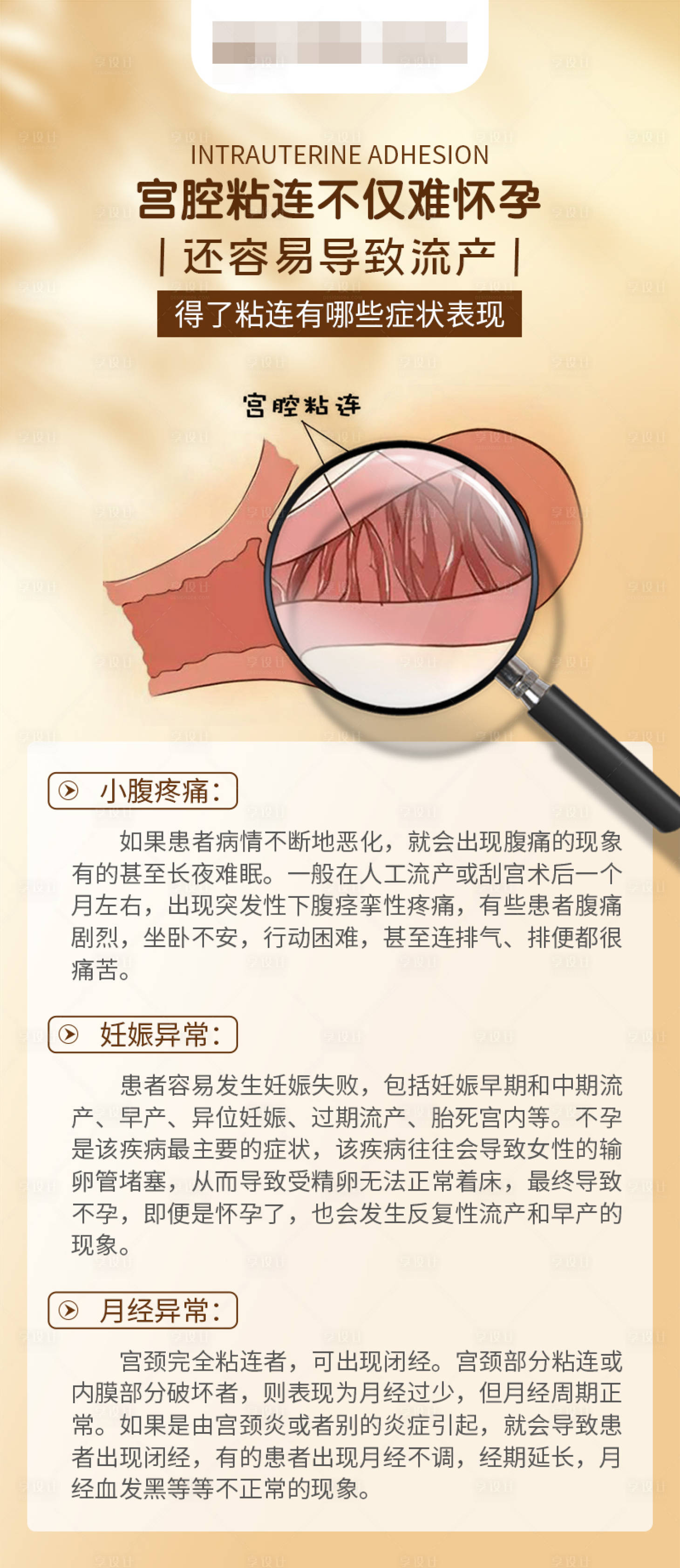 源文件下載【享設(shè)計(jì)】搜索編號(hào)：13600016711046234【宮腔粘連】