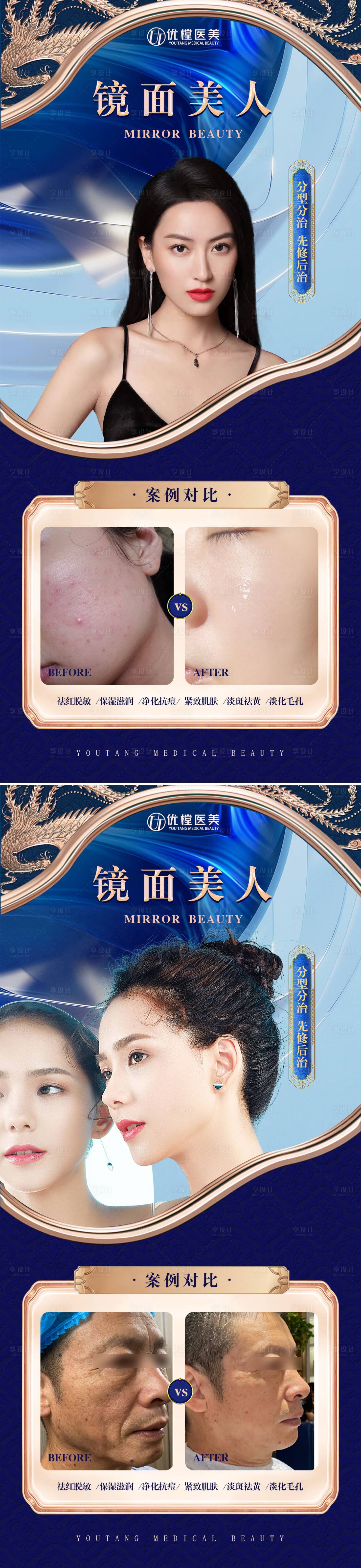 源文件下载【享设计】搜索编号：98960016601054137【医美案例对比】