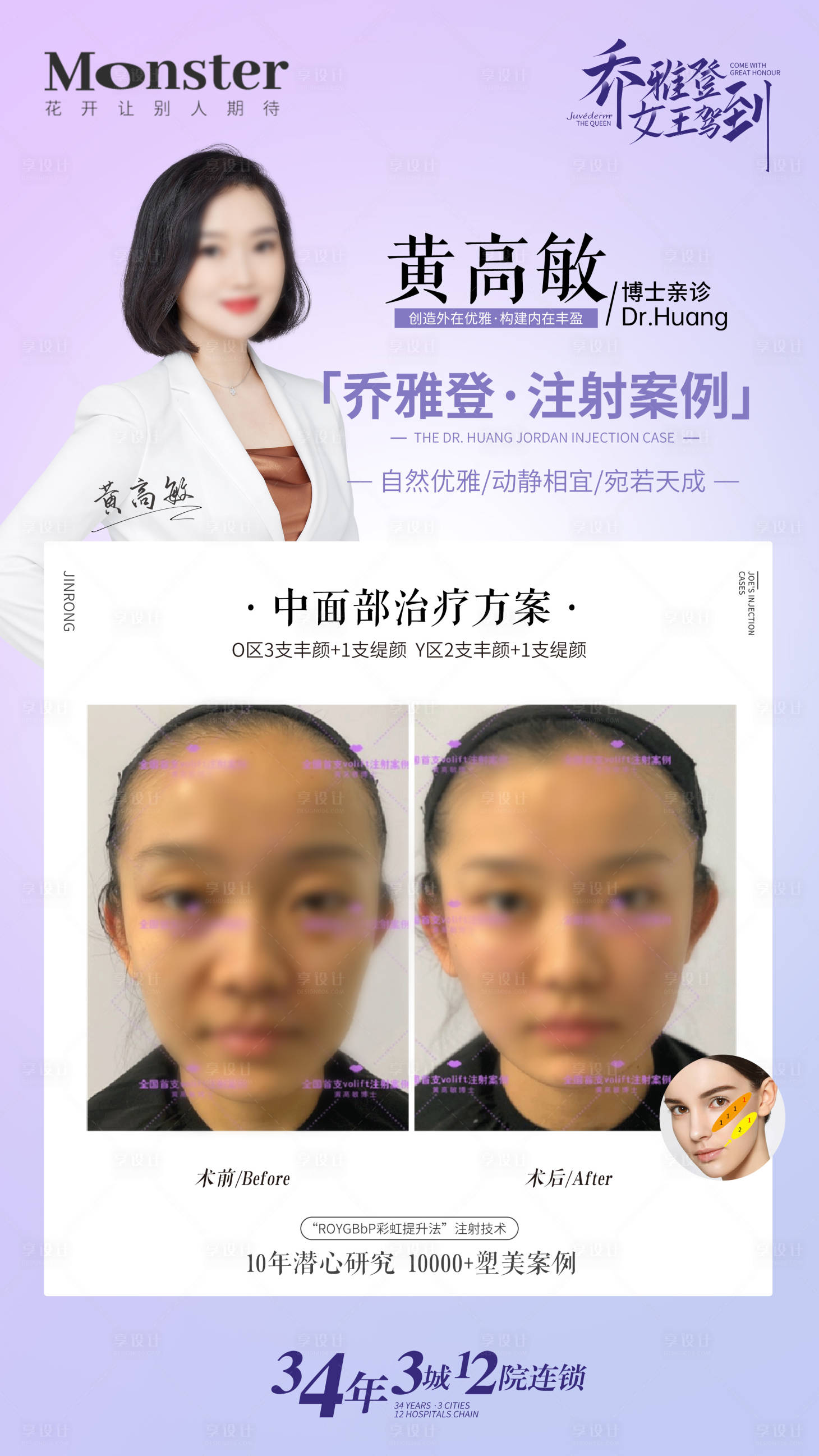 源文件下载【医美乔雅登案例海报】编号：45710016522537089