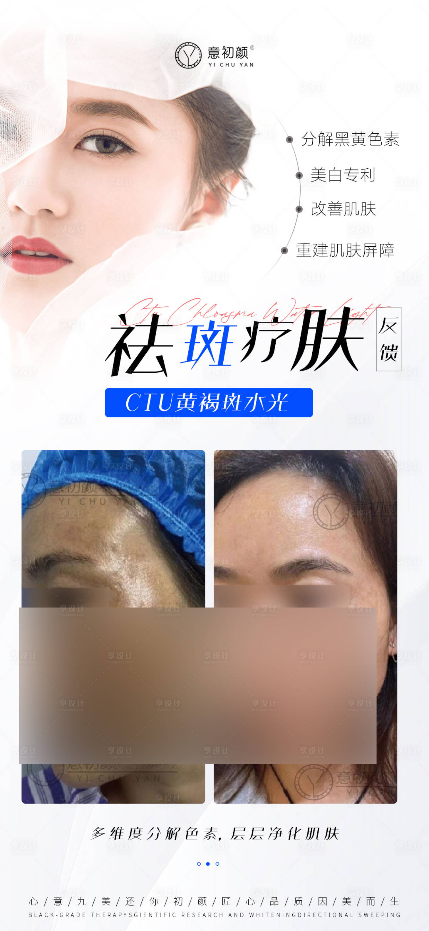 源文件下载【长沙医美美容祛斑美白痘痘模特对比简约】编号：53170016472941096