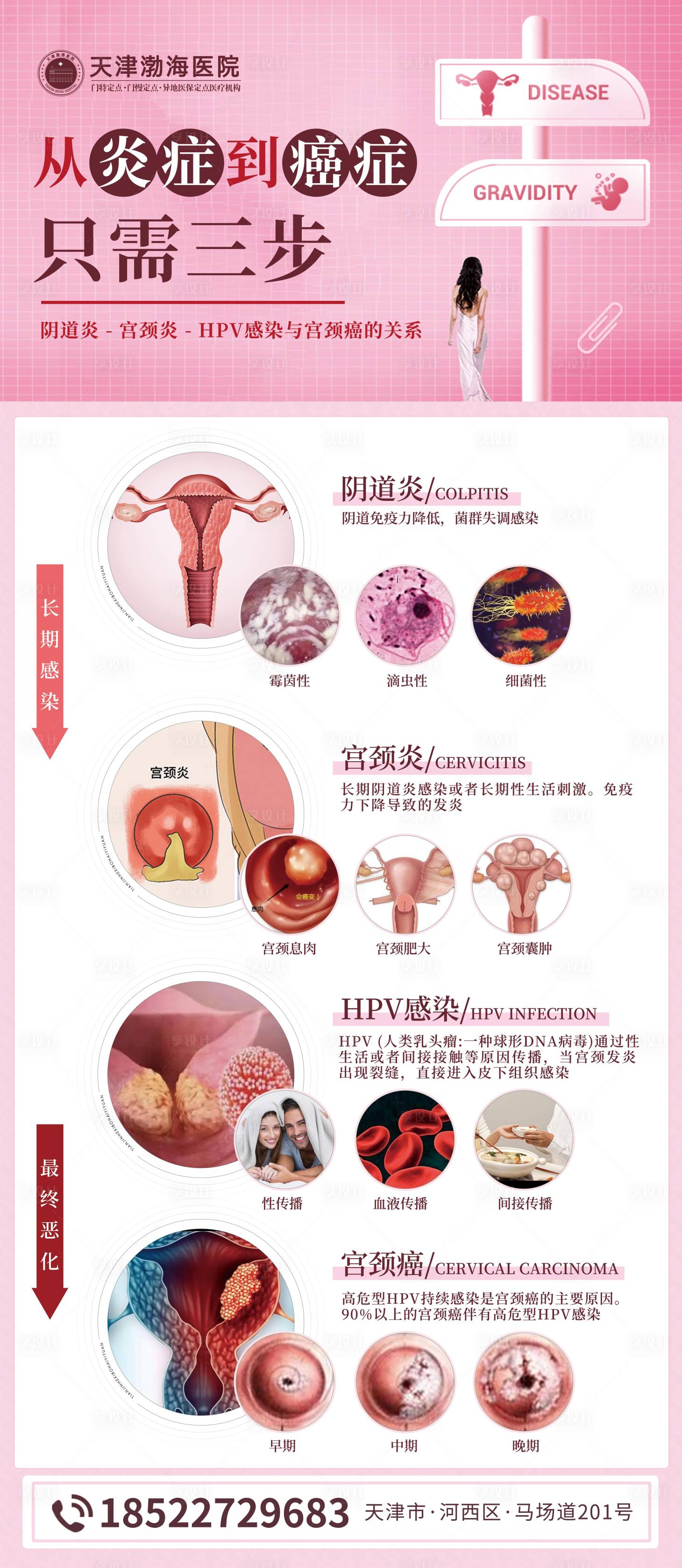 源文件下載【享設(shè)計(jì)】搜索編號(hào)：64470016775412627【hpv婦科展架】