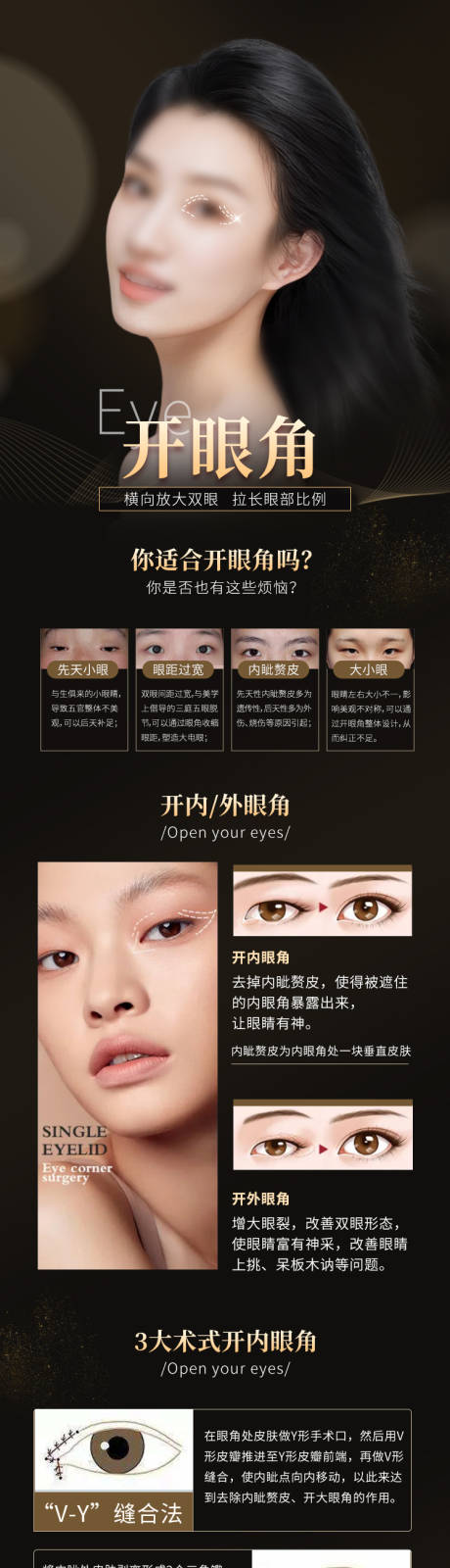 源文件下载【开眼角】编号：60720016411234108