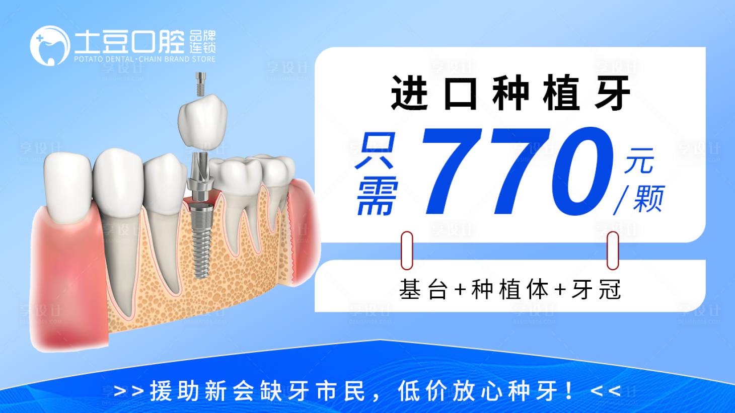 源文件下载【享设计】搜索编号：50360017058424540【口腔种植集采】