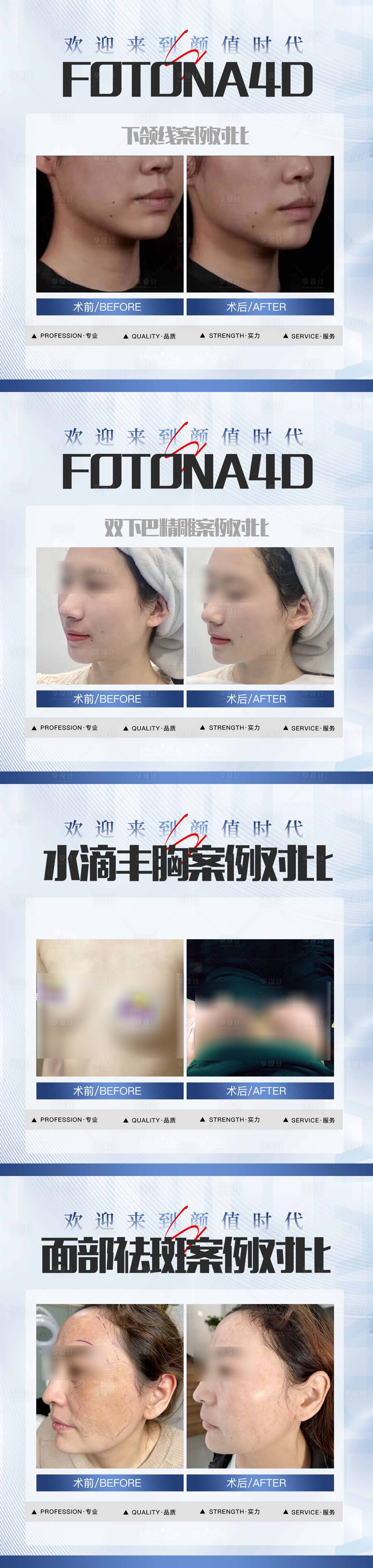 源文件下载【享设计】搜索编号：66530016750923897【医美案例系列海报】