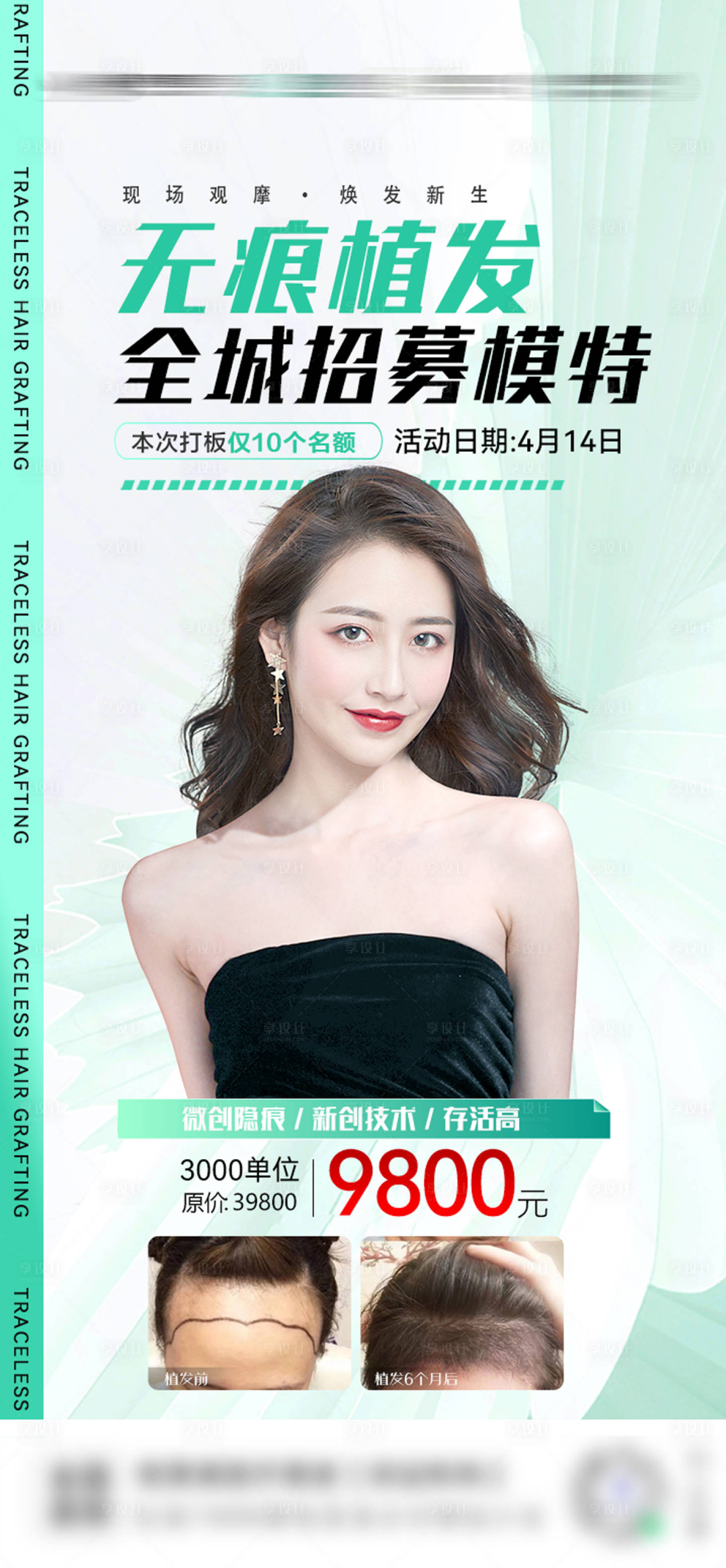 源文件下载【享设计】搜索编号：11140017007187804【植发模特招募海报】