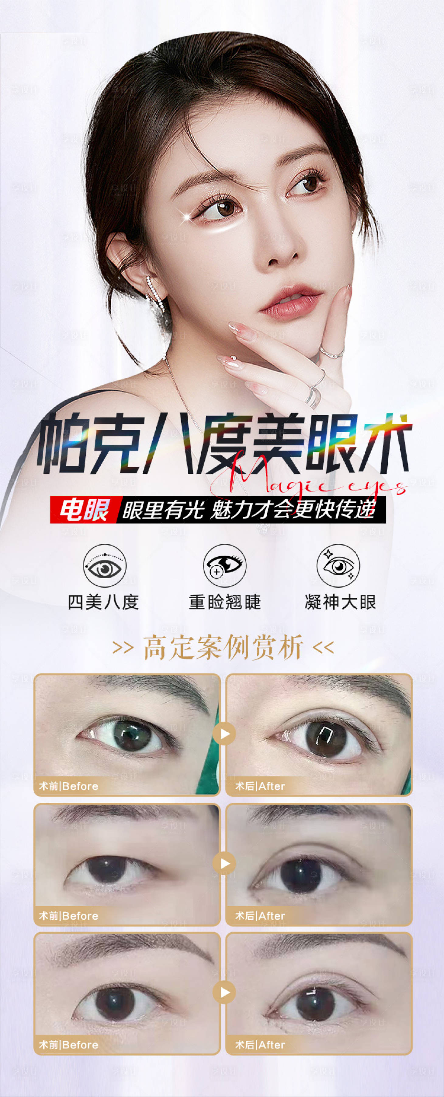 源文件下载【双眼眼部案例医美专家整形项目】编号：66150016625691603