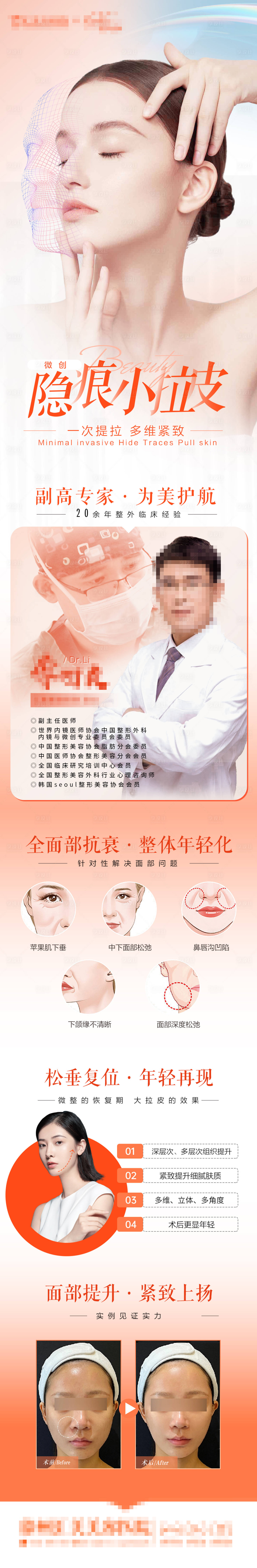 源文件下載【享設計】搜索編號：34760017060968399【醫美專家拉皮SMAS海報】