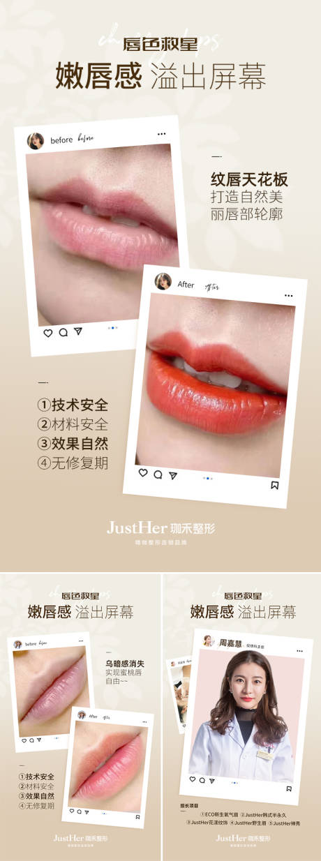 源文件下载【医美案例对比系列海报】编号：73800016806343170