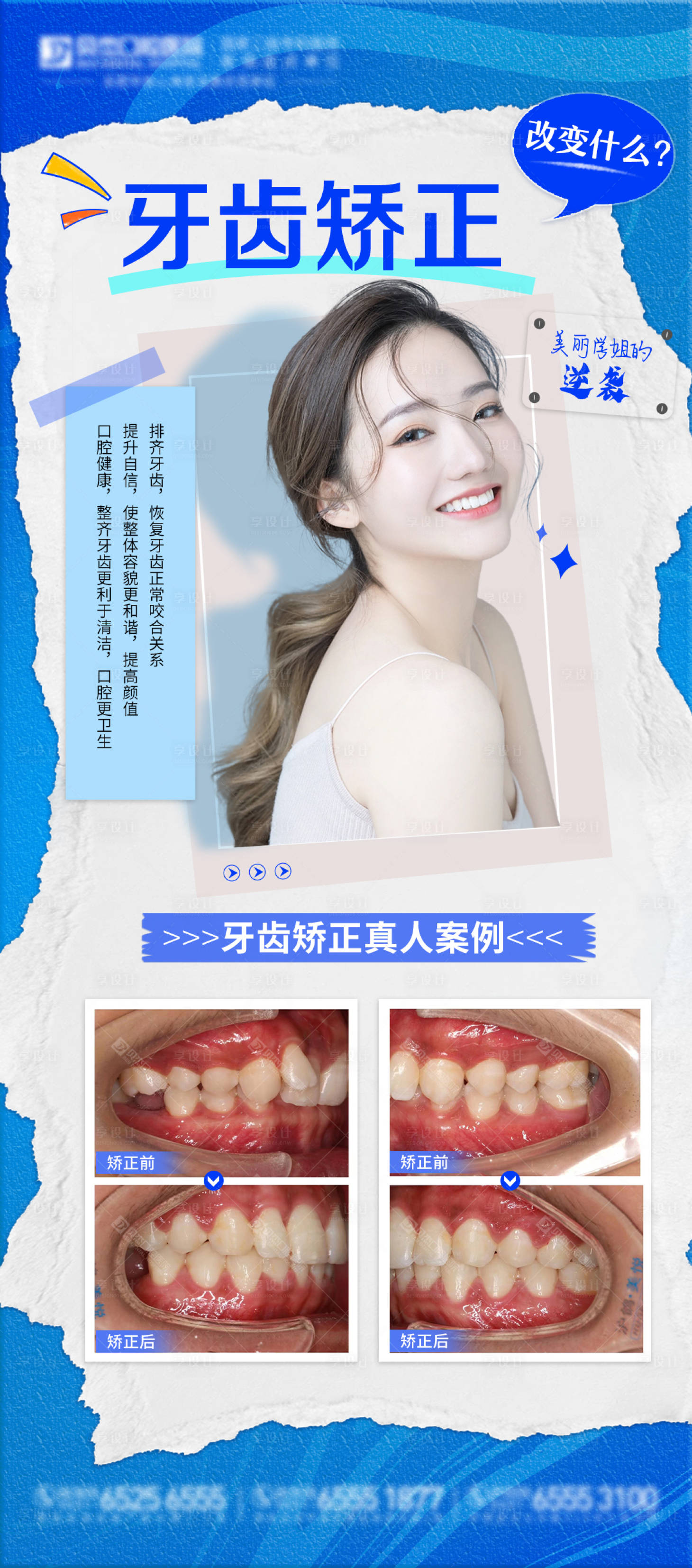 源文件下載【享設計】搜索編號：47380016733214660【牙齒矯正案例海報】