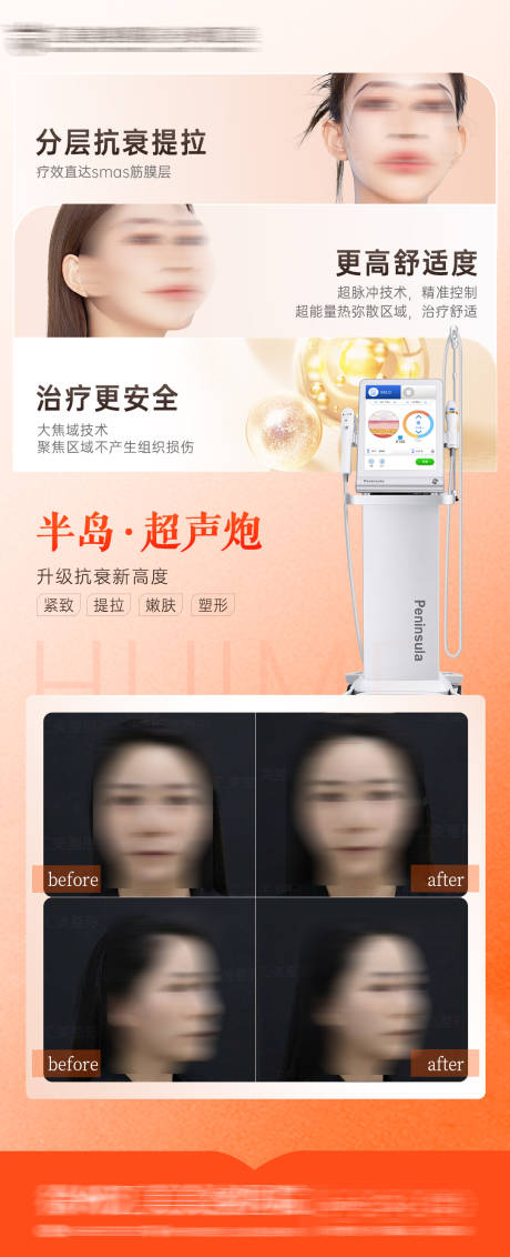 源文件下載【超聲炮】編號(hào)：75330016966642993