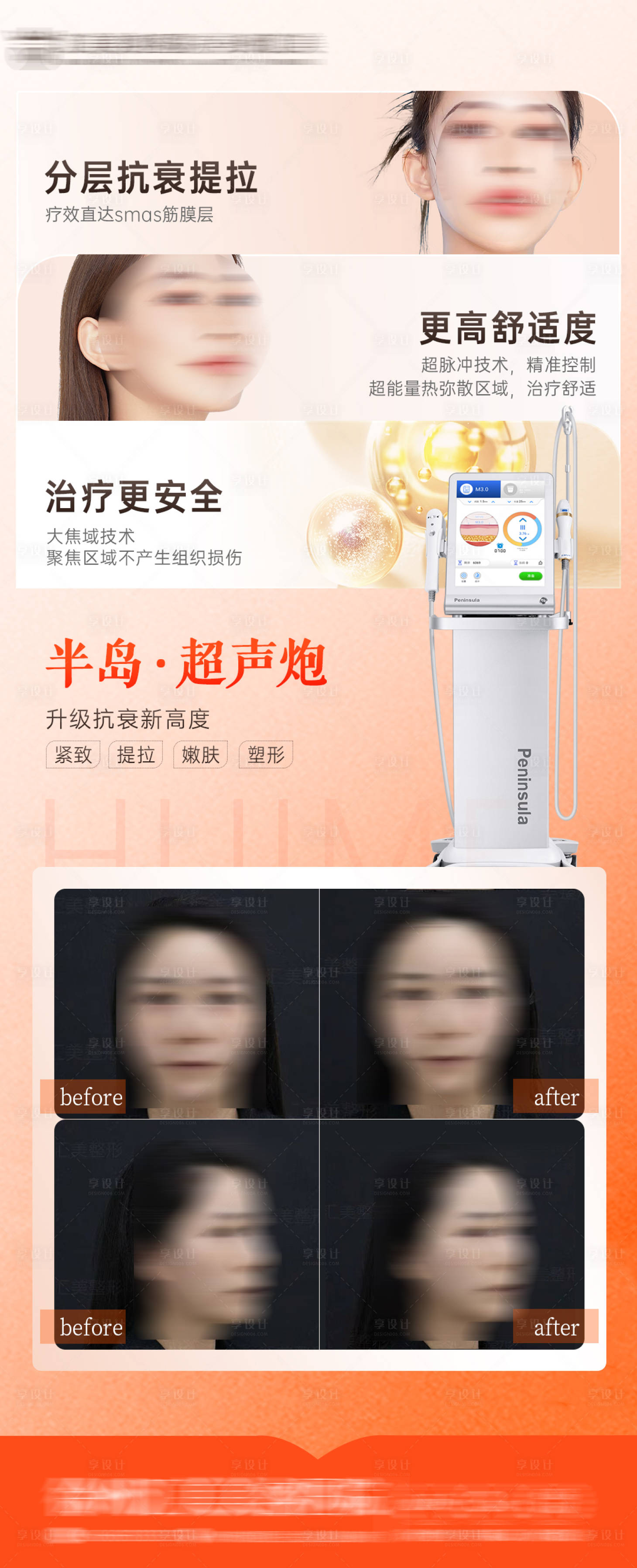 源文件下載【超聲炮】編號：75330016966642993