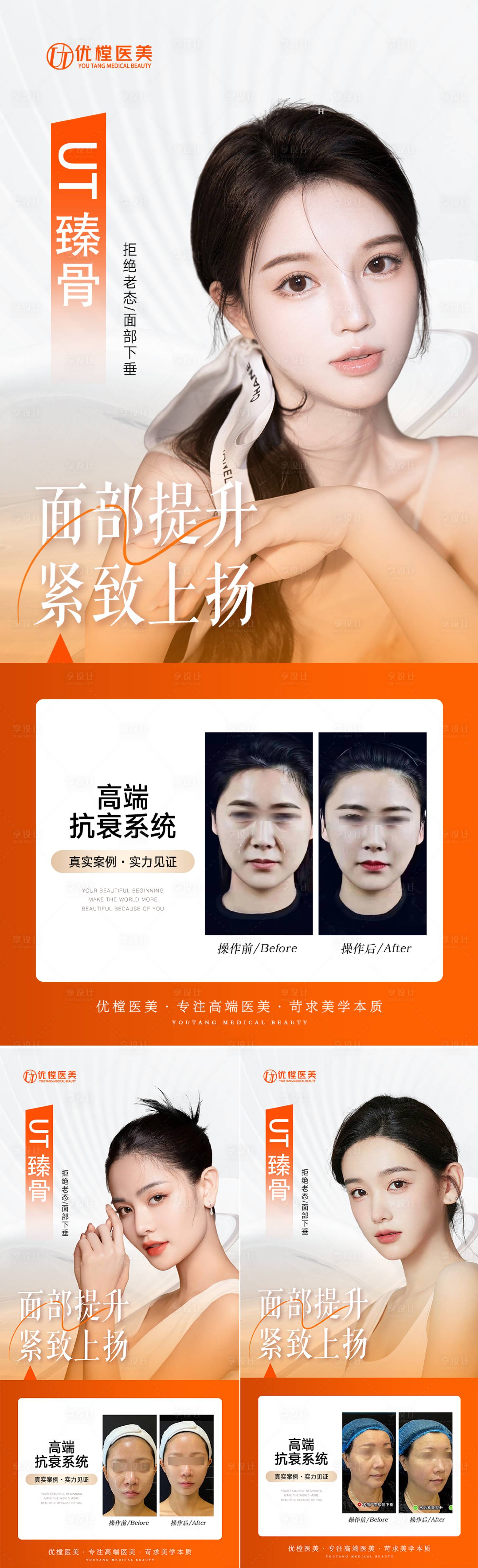 源文件下载【医美案例对比海报】编号：61070016828342806