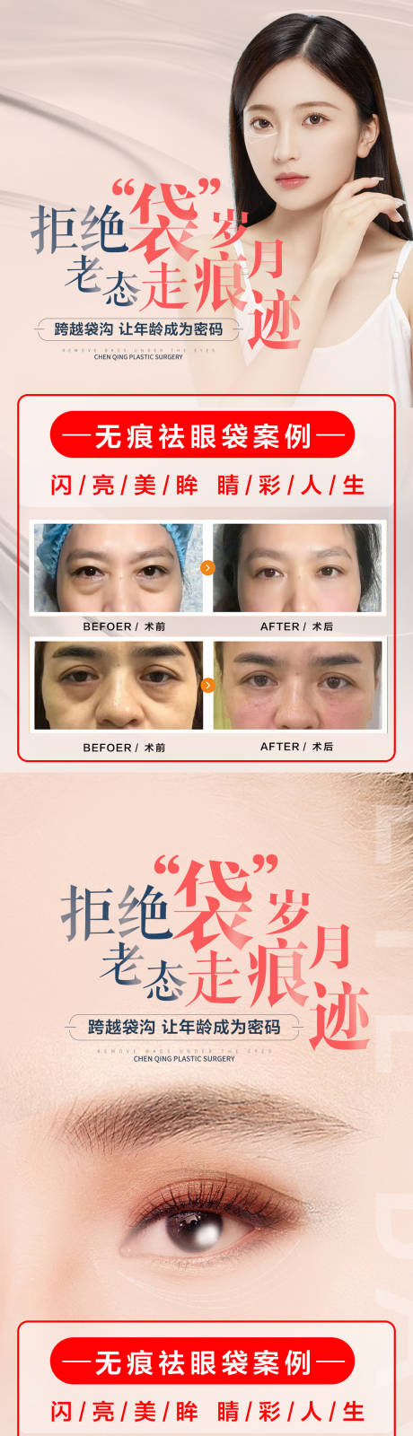 源文件下載【享設計】搜索編號：10540017698549514【祛眼袋案例海報】