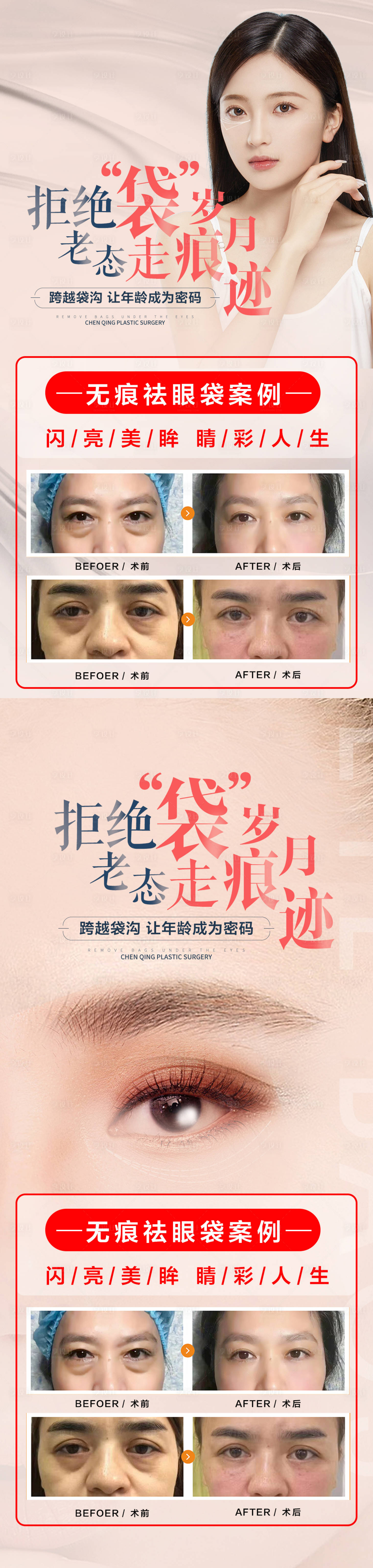 源文件下載【享設計】搜索編號：10540017698549514【祛眼袋案例海報】