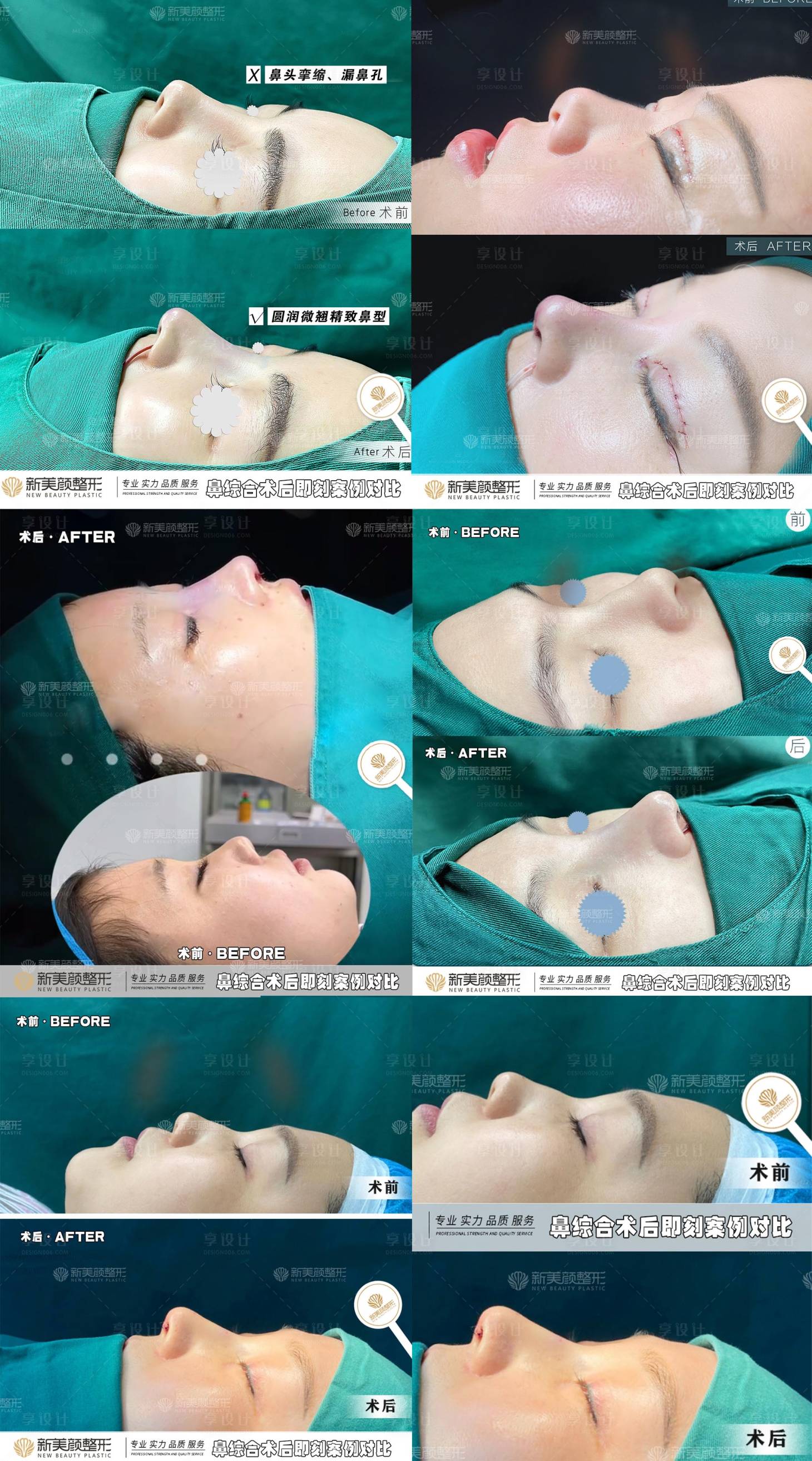 源文件下载【享设计】搜索编号：43720017135534309【医美案例宣传海报】