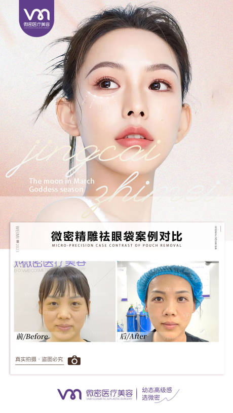 源文件下载【医美案例】编号：81130017449588789