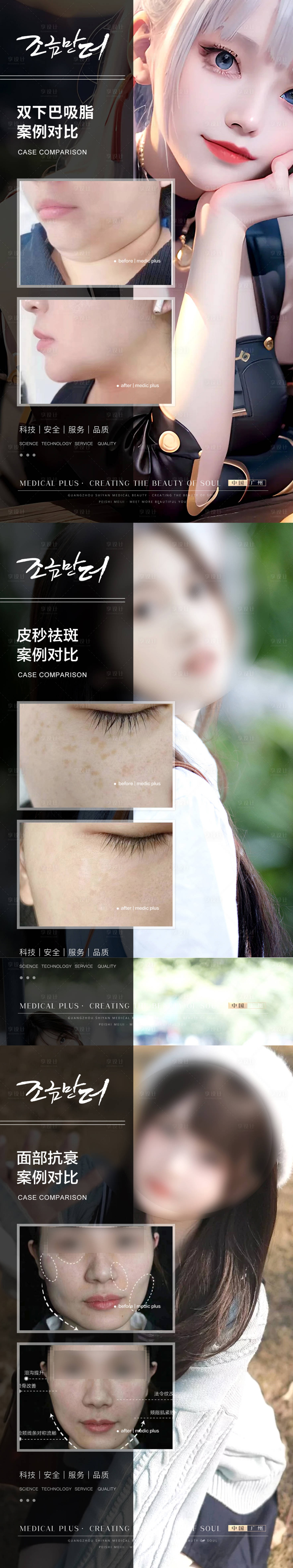 源文件下载【享设计】搜索编号：76870017564563163【医美案例海报】