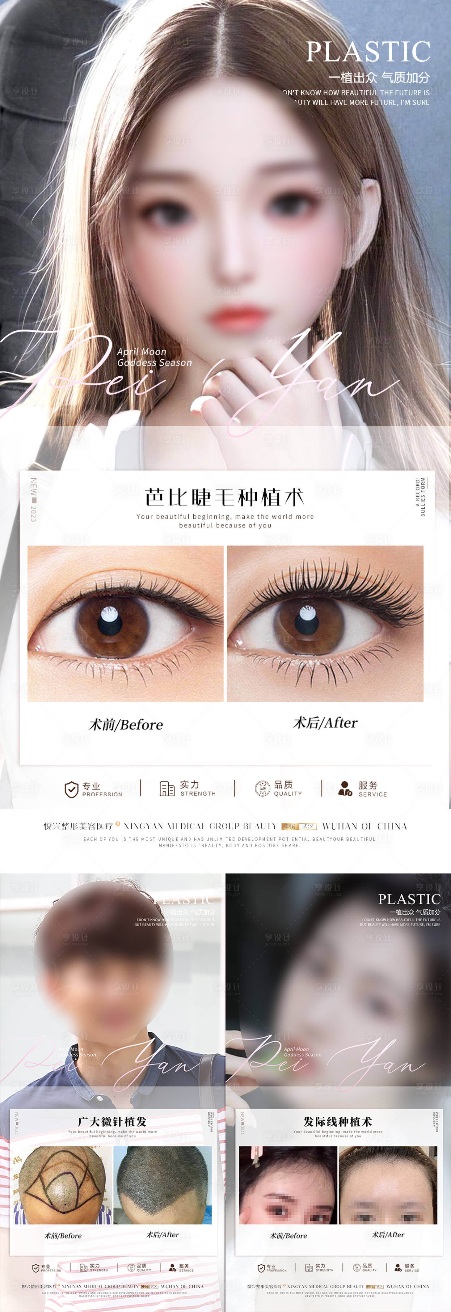 源文件下载【享设计】搜索编号：65070017579484504【植发案例海报】