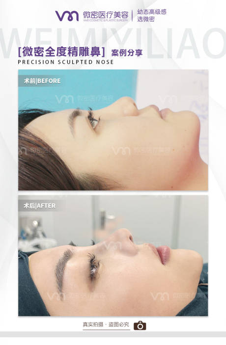 源文件下载【医美案例】编号：67860017512855563